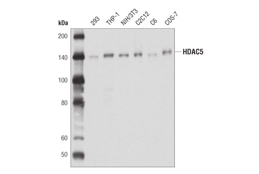  Image 2: Class II HDAC Antibody Sampler Kit