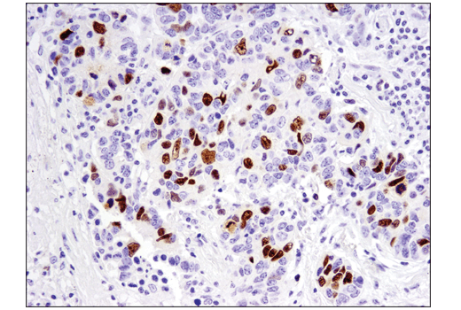 Immunohistochemistry Image 1: FoxM1 (D3F2B) Rabbit mAb
