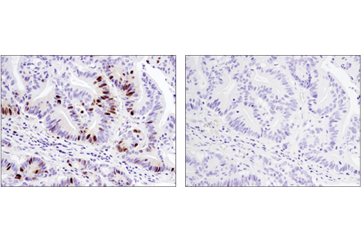 Immunohistochemistry Image 4: FoxM1 (D3F2B) Rabbit mAb