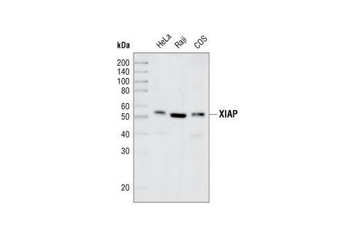  Image 1: IAP Family Antibody Sampler Kit