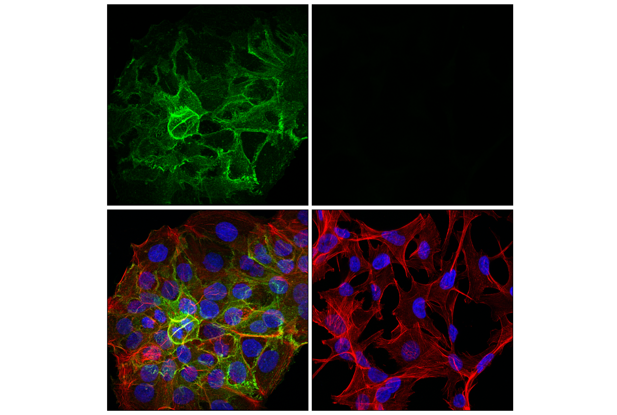 Immunofluorescence Image 1: Desmoglein 3 (5G11) Mouse mAb