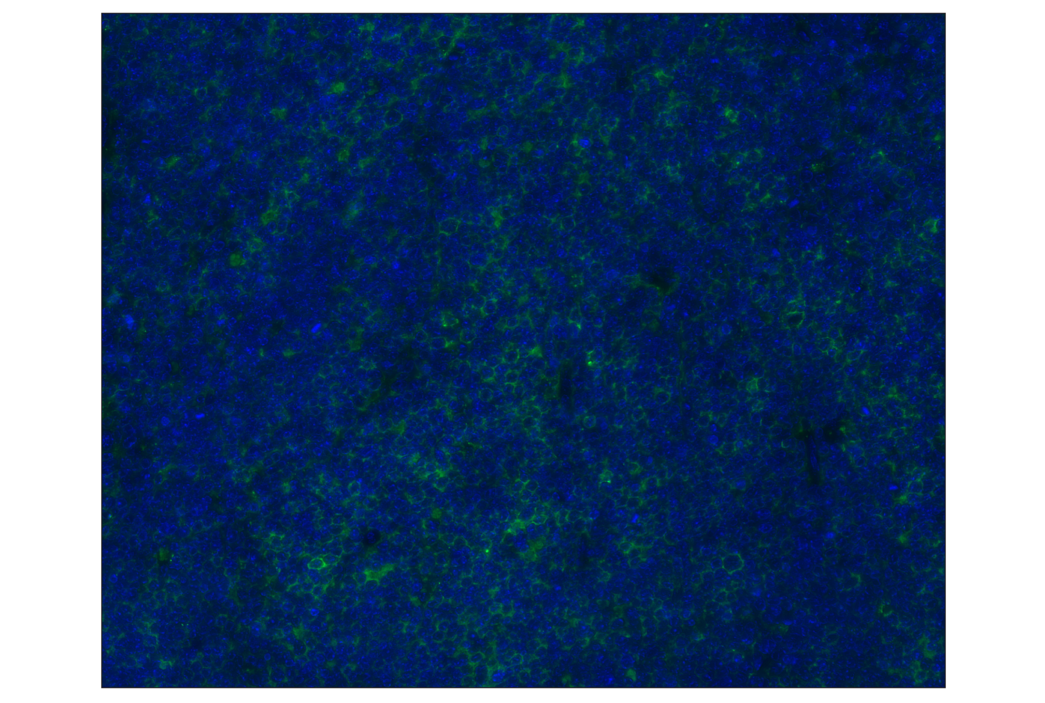 Immunohistochemistry Image 1: PD-L1 (D5V3B) Rabbit mAb (Alexa Fluor® 488 Conjugate)