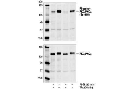  Image 1: Phospho-PKC Antibody Sampler Kit