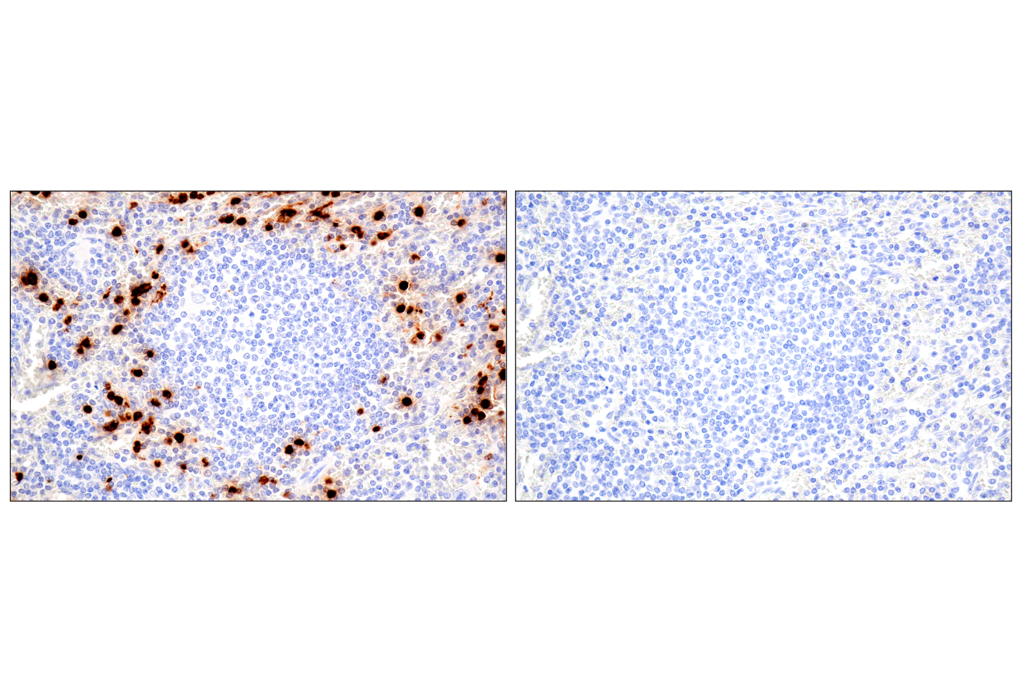 Immunohistochemistry Image 14: Eosinophil cationic protein (E6U5M) Rabbit mAb (BSA and Azide Free)