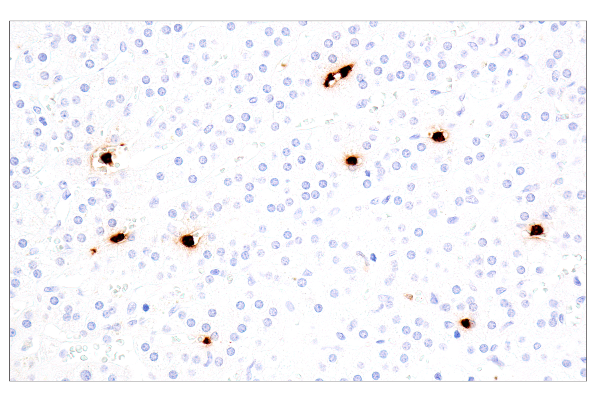 Immunohistochemistry Image 13: Eosinophil cationic protein (E6U5M) Rabbit mAb (BSA and Azide Free)