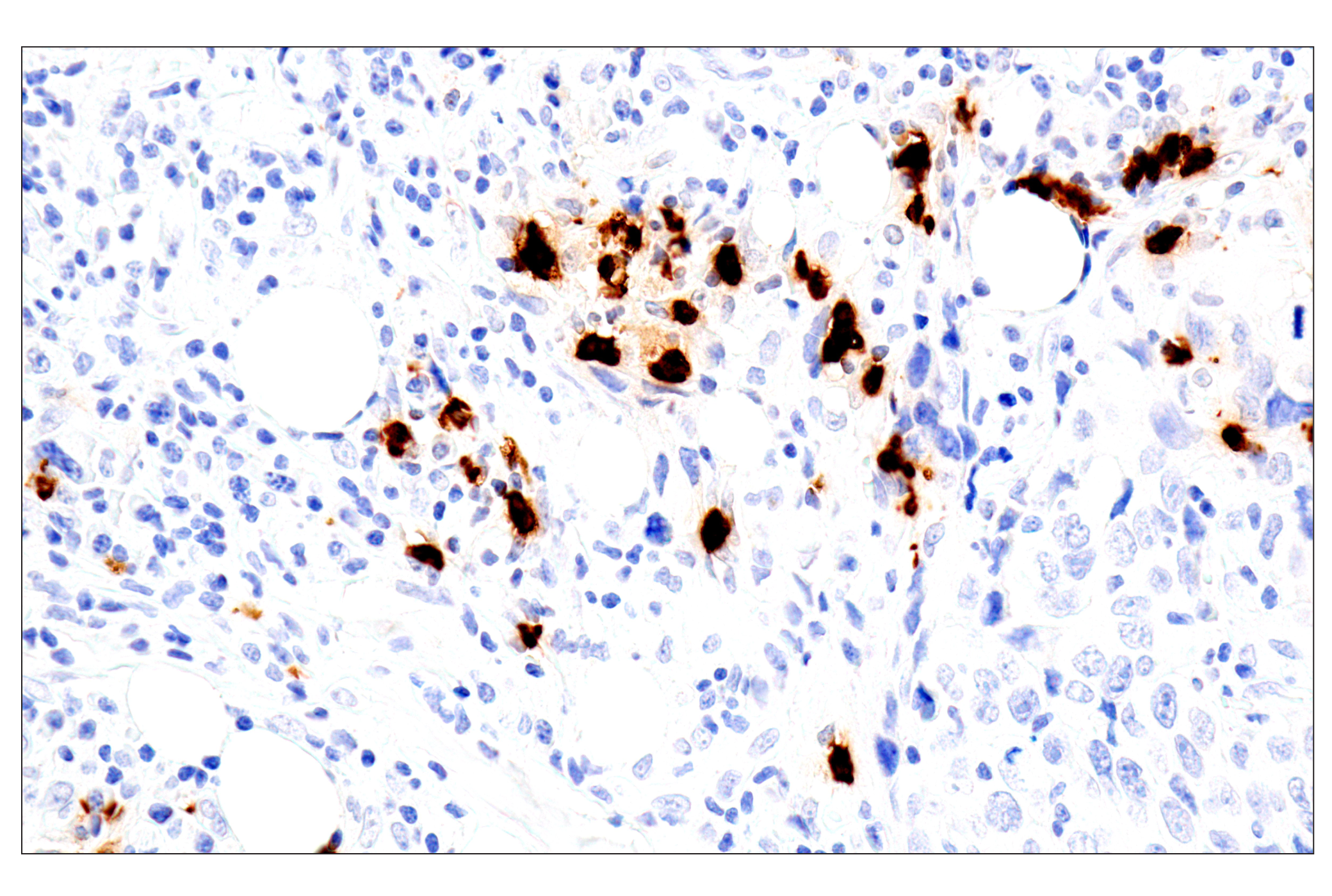 Immunohistochemistry Image 6: Eosinophil cationic protein (E6U5M) Rabbit mAb (BSA and Azide Free)