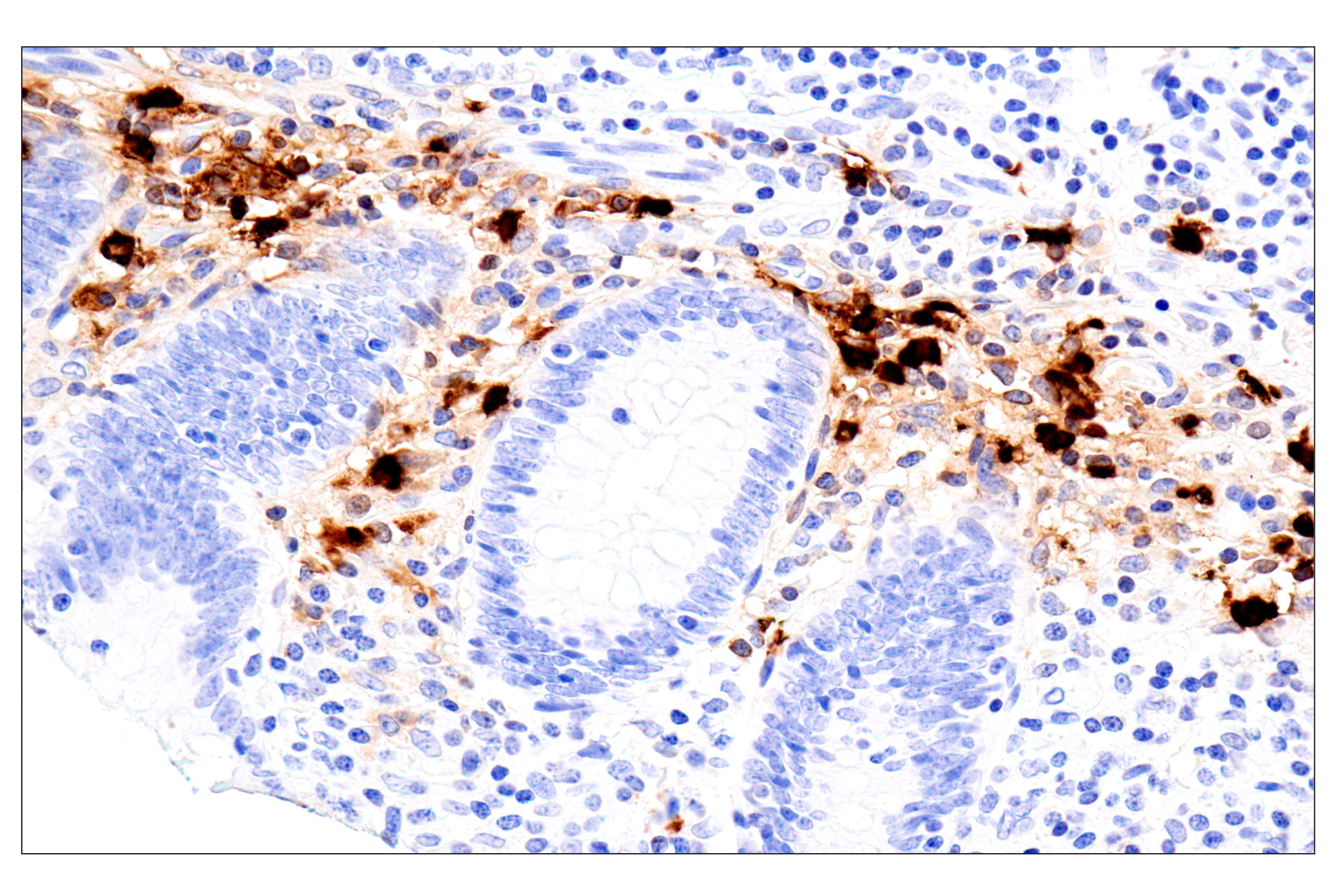 Immunohistochemistry Image 11: Eosinophil cationic protein (E6U5M) Rabbit mAb (BSA and Azide Free)