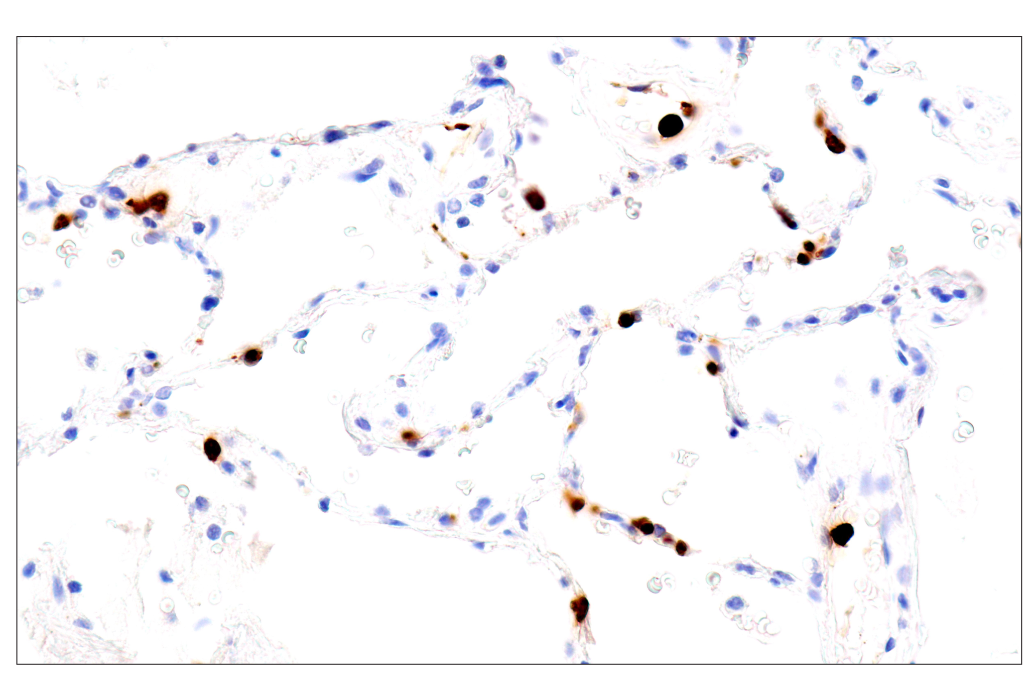 Immunohistochemistry Image 12: Eosinophil cationic protein (E6U5M) Rabbit mAb (BSA and Azide Free)