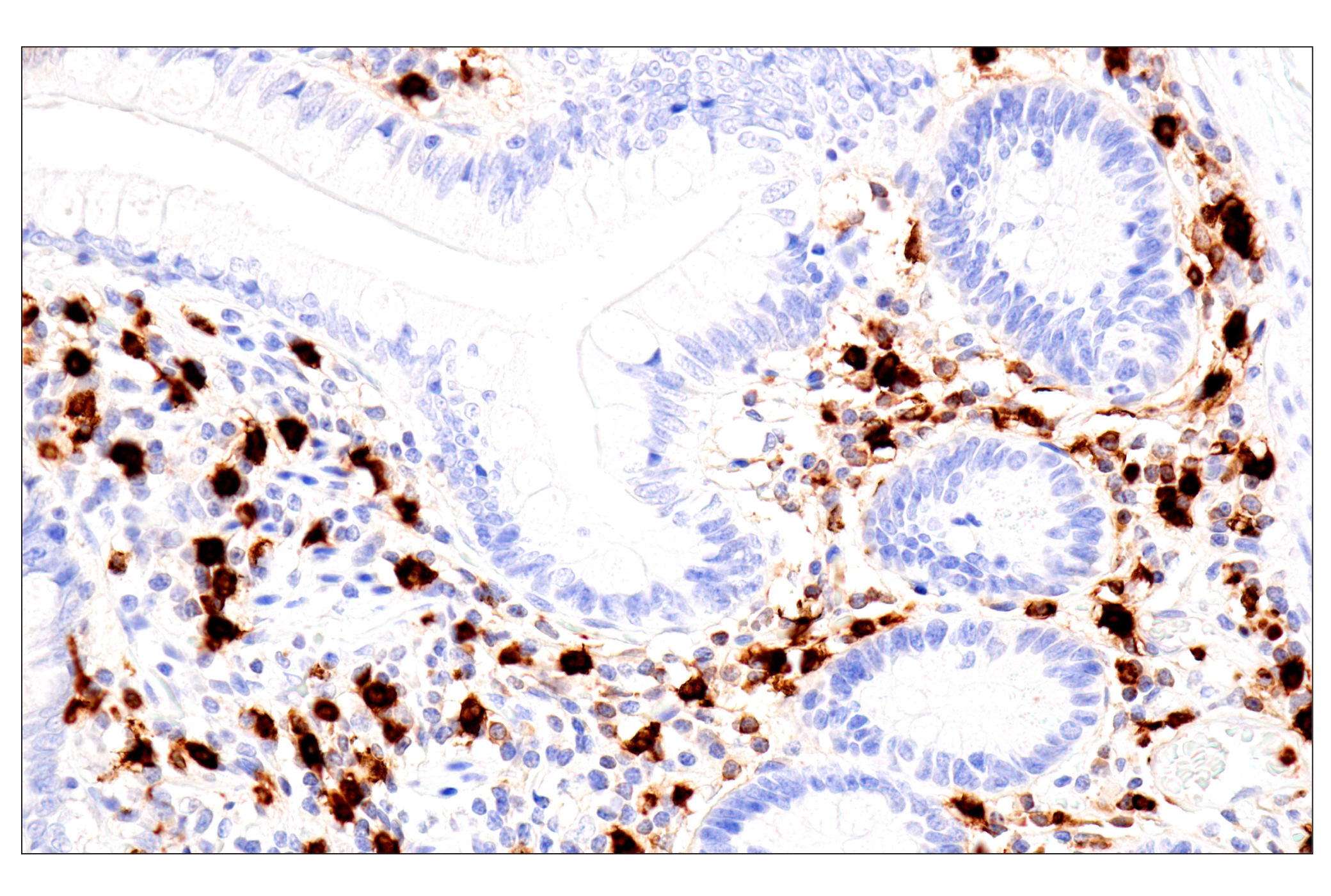 Immunohistochemistry Image 10: Eosinophil cationic protein (E6U5M) Rabbit mAb (BSA and Azide Free)