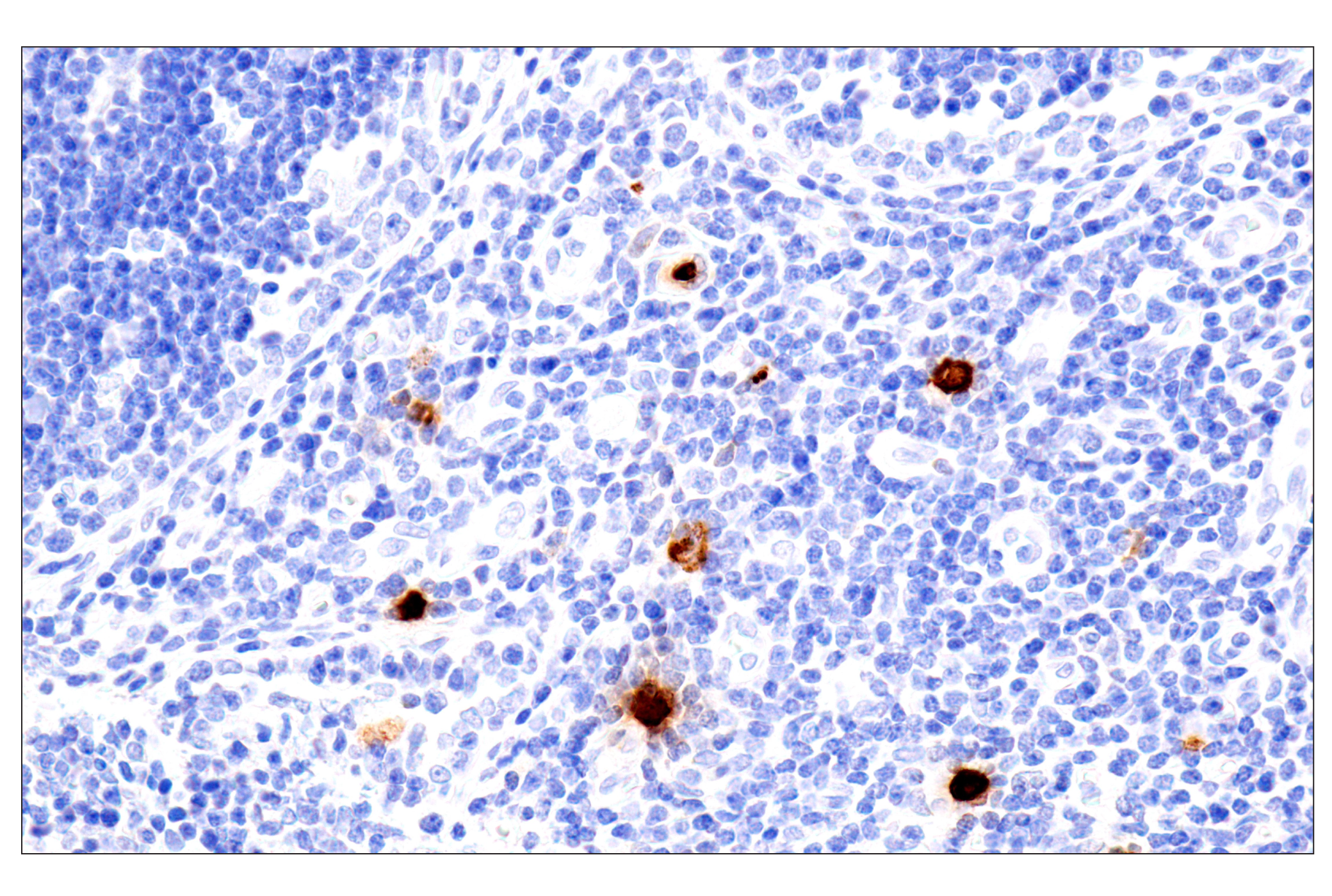 Immunohistochemistry Image 8: Eosinophil cationic protein (E6U5M) Rabbit mAb (BSA and Azide Free)