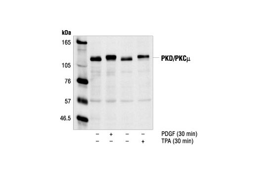 Western Blotting Image 1: PKD/PKCμ Antibody