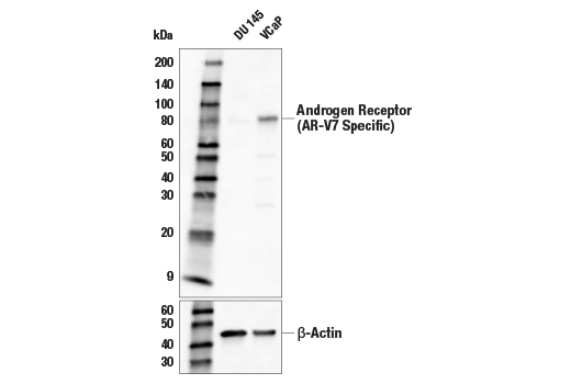 Western Blotting Image 1: Androgen Receptor (AR-V7 Specific) (E3O8L) Rabbit mAb (Biotinylated)