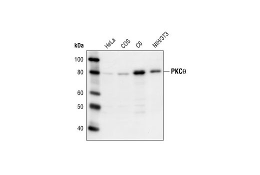Western Blotting Image 1: PKCθ Antibody