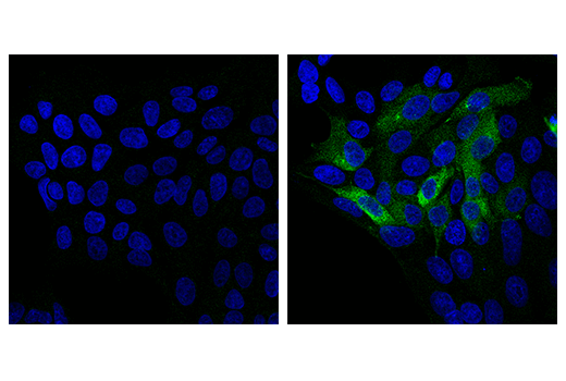 Immunofluorescence Image 1: iNOS (E3W6B) Rabbit mAb