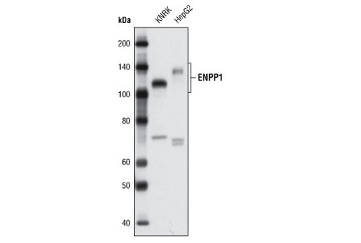 Western Blotting Image 1: ENPP1 (L520) Antibody
