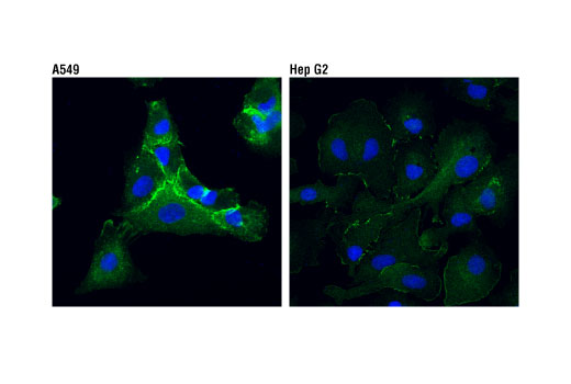 Immunofluorescence Image 1: IQGAP1 (D8K4X) XP® Rabbit mAb