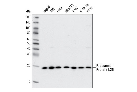 Western Blotting Image 1: Ribosomal Protein L26 Antibody