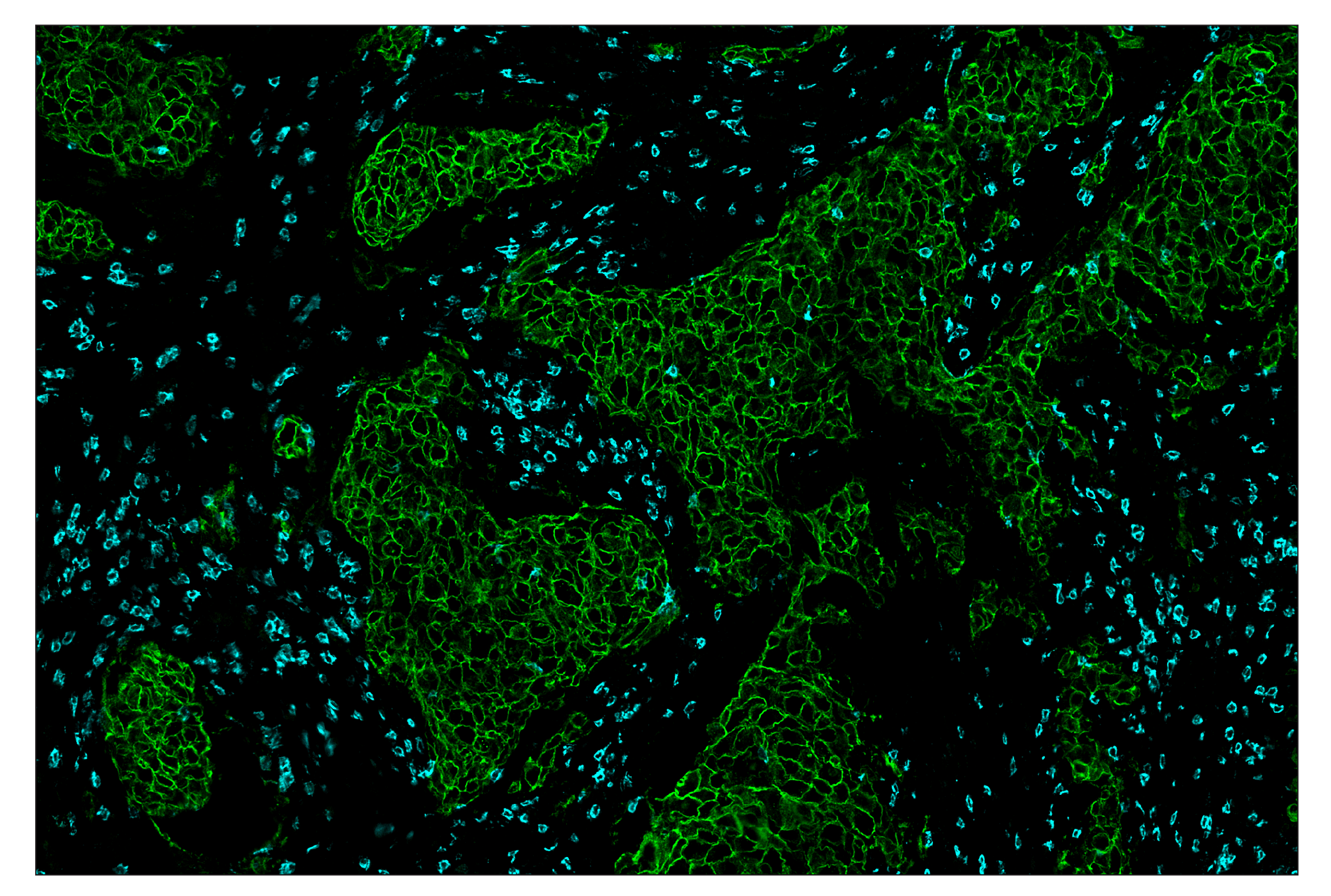 Immunohistochemistry Image 7: HER2/ErbB2 (D8F12) & CO-0019-488 SignalStar™ Oligo-Antibody Pair