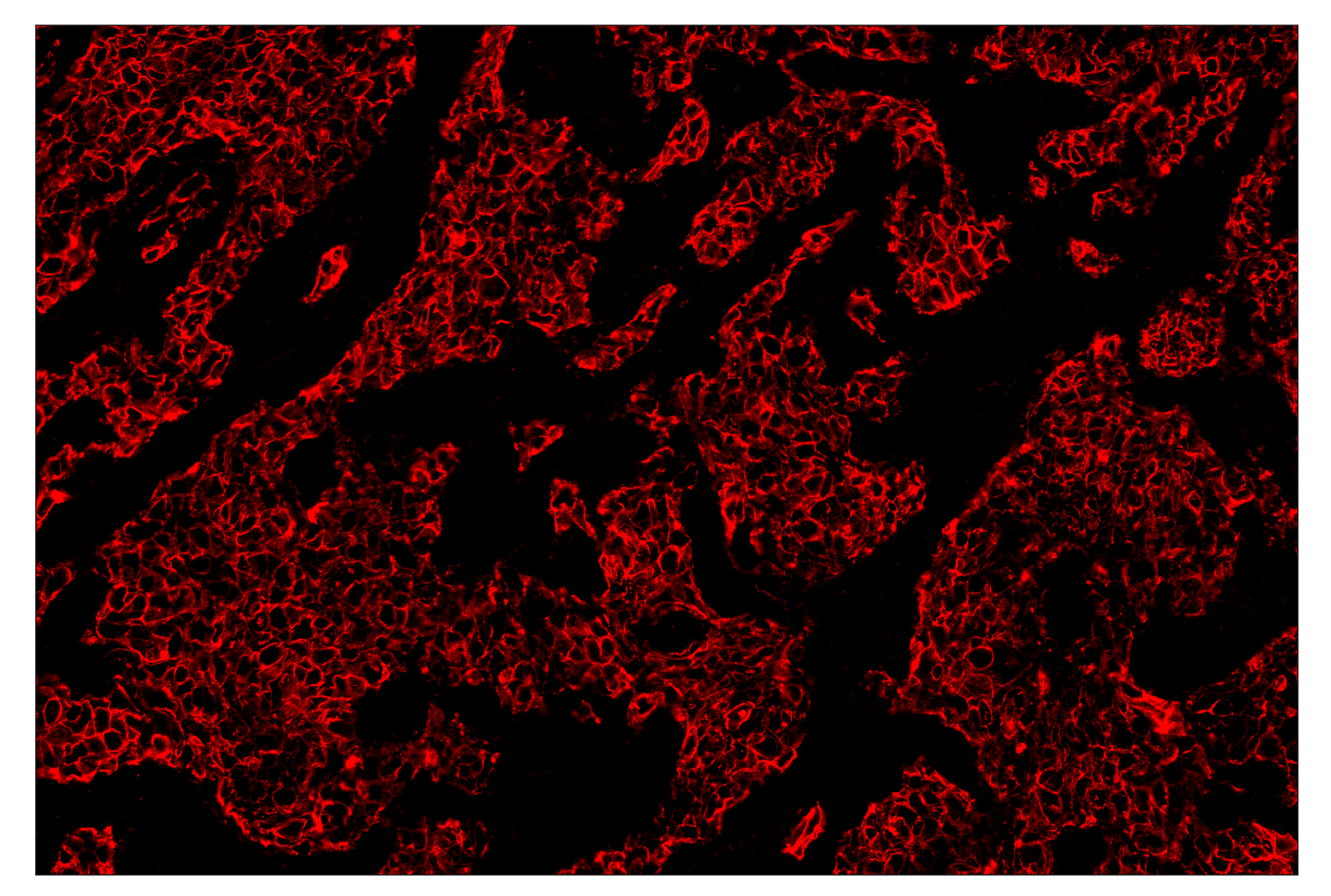 Immunohistochemistry Image 4: HER2/ErbB2 (D8F12) & CO-0019-488 SignalStar™ Oligo-Antibody Pair