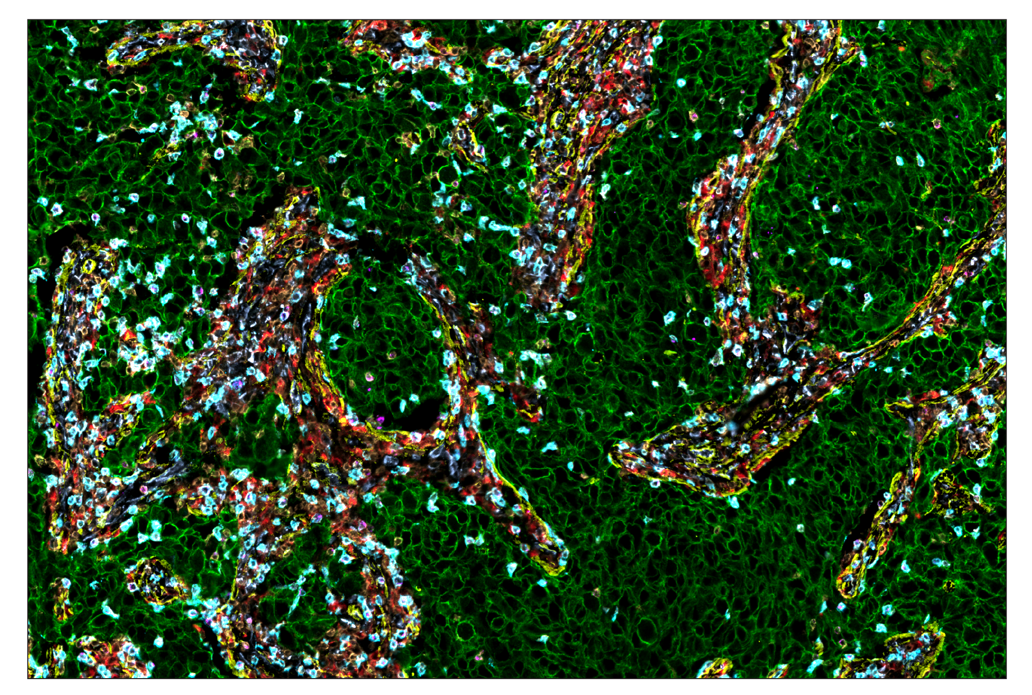 Immunohistochemistry Image 1: HER2/ErbB2 (D8F12) & CO-0019-488 SignalStar™ Oligo-Antibody Pair
