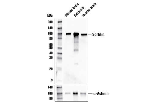 Western Blotting Image 1: Sortilin Antibody