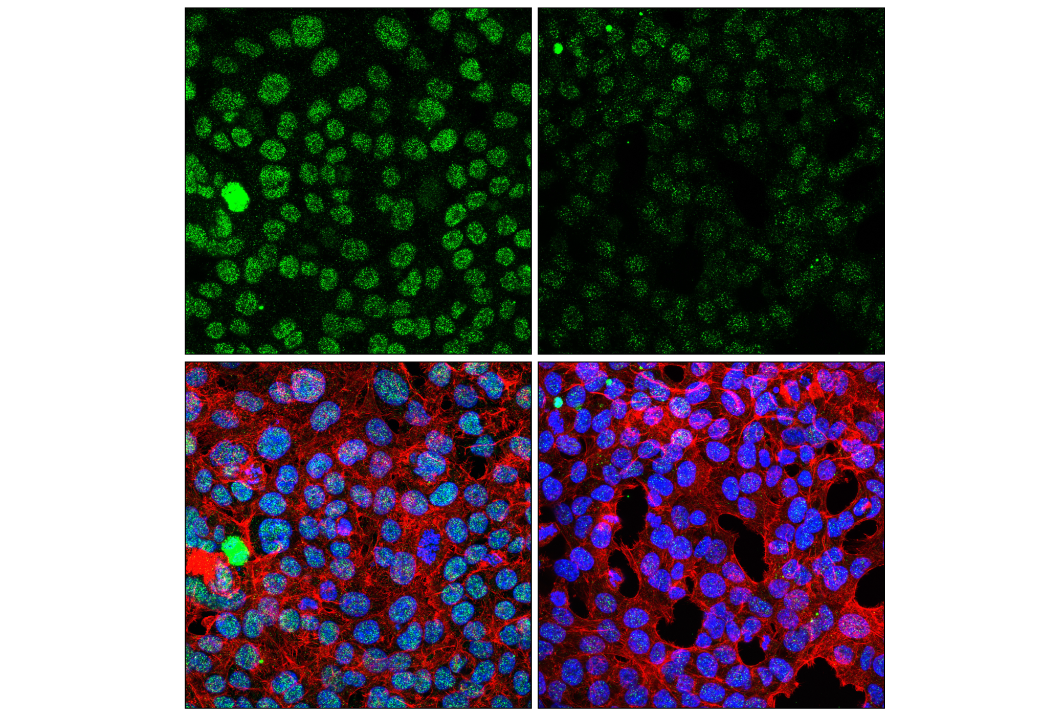 Immunofluorescence Image 1: BRD4 Isoform C (E1Q9N) Rabbit mAb