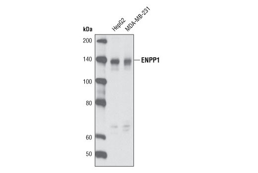 Western Blotting Image 1: ENPP1 Antibody (Human Specific)