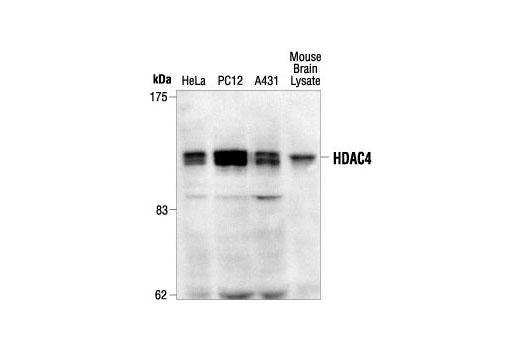 Western Blotting Image 1: Histone Deacetylase 4 (HDAC4) Antibody