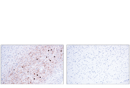 Immunohistochemistry Image 1: Phospho-Tau (Thr205) (E7D3E) Rabbit mAb (BSA and Azide Free)