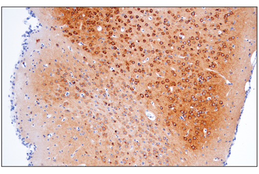 Immunohistochemistry Image 2: Phospho-Tau (Thr205) (E7D3E) Rabbit mAb (BSA and Azide Free)
