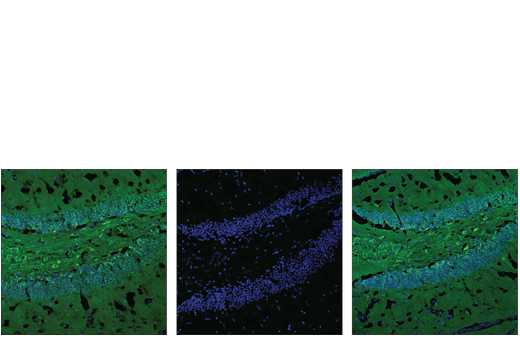 Immunofluorescence Image 2: Phospho-Tau (Thr205) (E7D3E) Rabbit mAb (BSA and Azide Free)