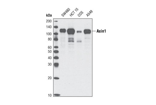 Western Blotting Image 1: Axin1 (C95H11) Rabbit mAb