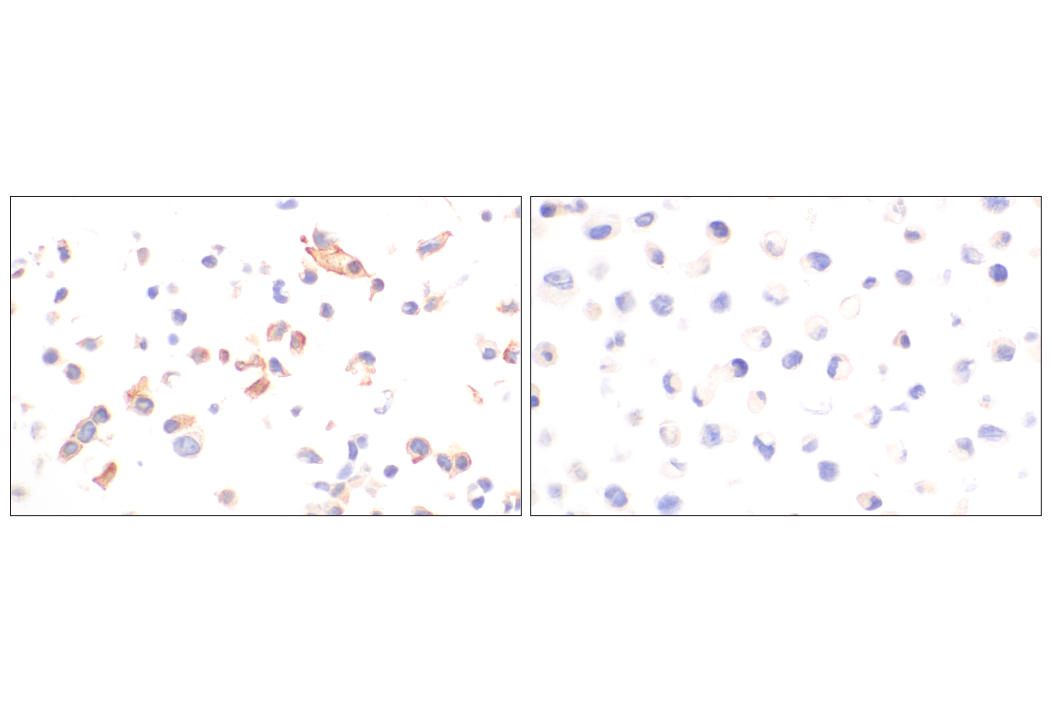 Immunohistochemistry Image 9: OLR1/LOX1 (E9C5A) Rabbit mAb (BSA and Azide Free)