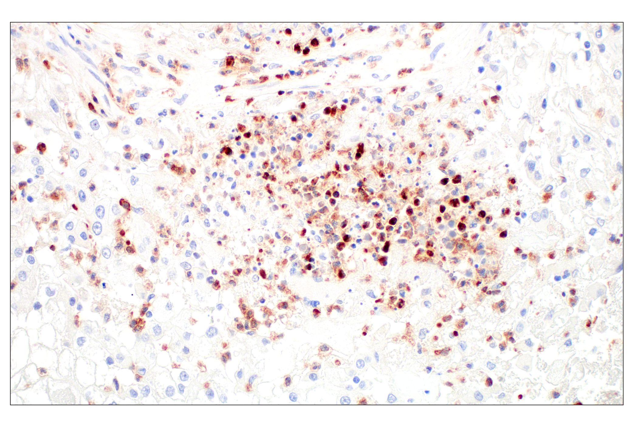 Immunohistochemistry Image 3: OLR1/LOX1 (E9C5A) Rabbit mAb (BSA and Azide Free)