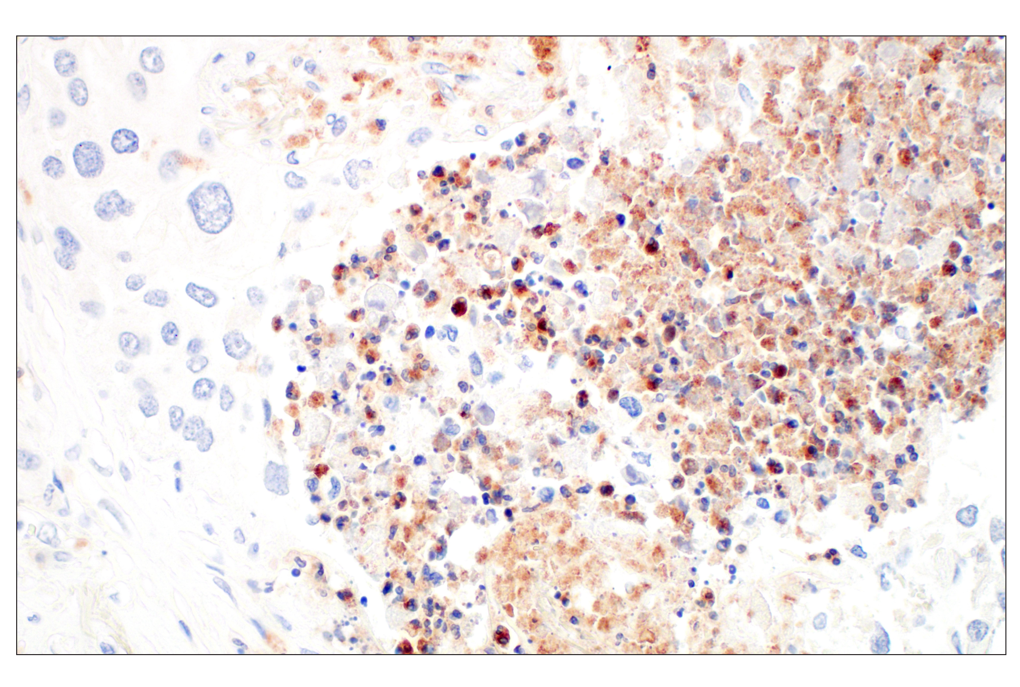 Immunohistochemistry Image 7: OLR1/LOX1 (E9C5A) Rabbit mAb (BSA and Azide Free)