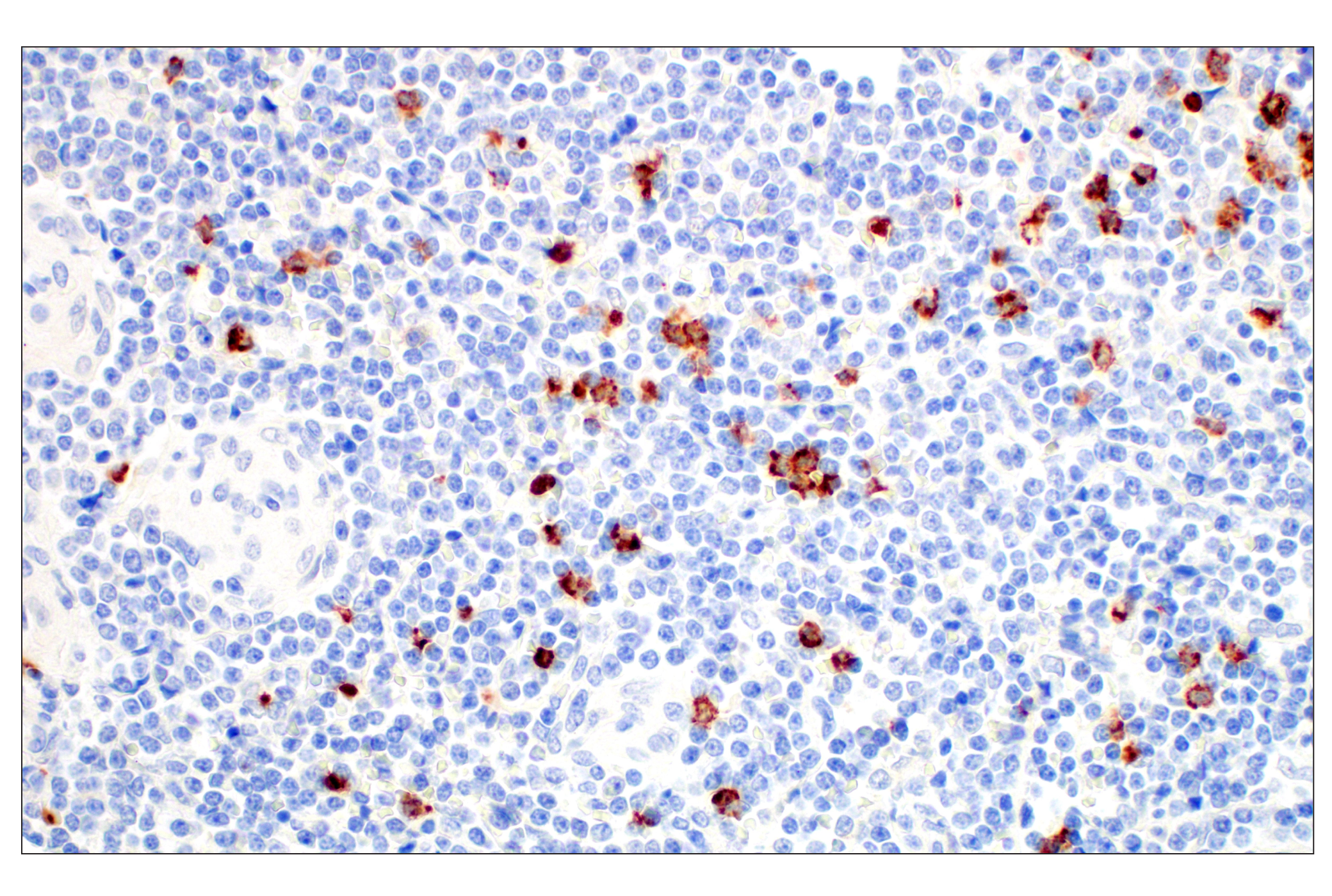 Immunohistochemistry Image 6: OLR1/LOX1 (E9C5A) Rabbit mAb (BSA and Azide Free)