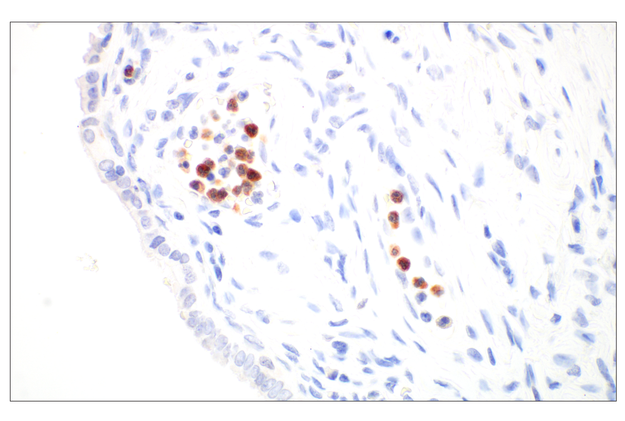 Immunohistochemistry Image 5: OLR1/LOX1 (E9C5A) Rabbit mAb (BSA and Azide Free)
