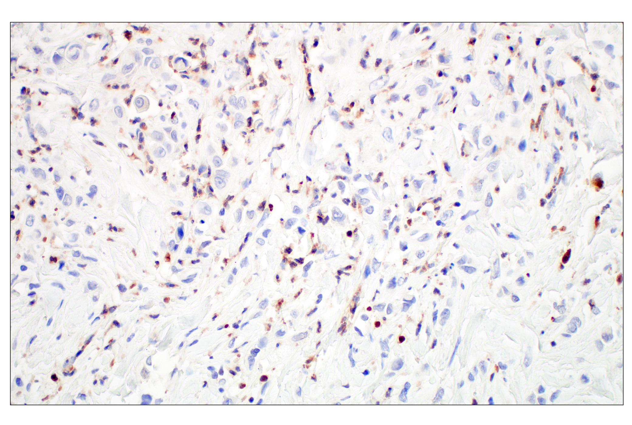 Immunohistochemistry Image 4: OLR1/LOX1 (E9C5A) Rabbit mAb (BSA and Azide Free)