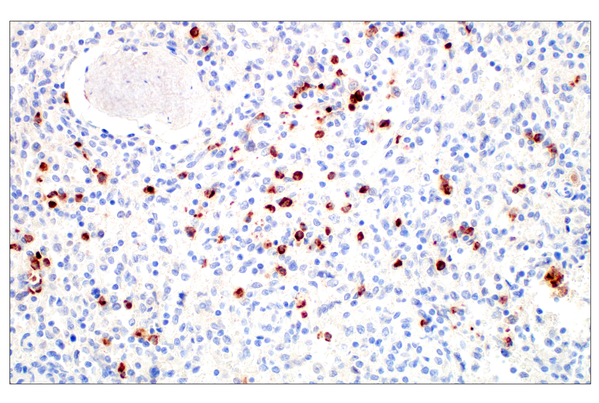 Immunohistochemistry Image 1: OLR1/LOX1 (E9C5A) Rabbit mAb (BSA and Azide Free)