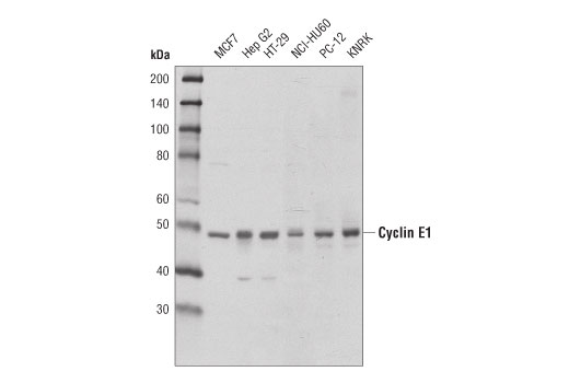  Image 2: Cell Cycle Phase Determination Antibody Sampler Kit