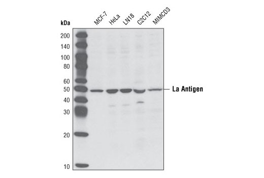 Western Blotting Image 1: La Antigen Antibody
