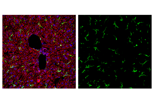 Immunofluorescence Image 2: Iba1/AIF-1 (E4O4W) XP® Rabbit mAb (Alexa Fluor® 488 Conjugate)