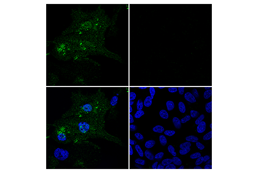 Immunofluorescence Image 3: Iba1/AIF-1 (E4O4W) XP® Rabbit mAb (Alexa Fluor® 488 Conjugate)