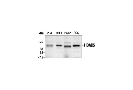 Western Blotting Image 1: Histone Deacetylase 5 (HDAC5) Antibody