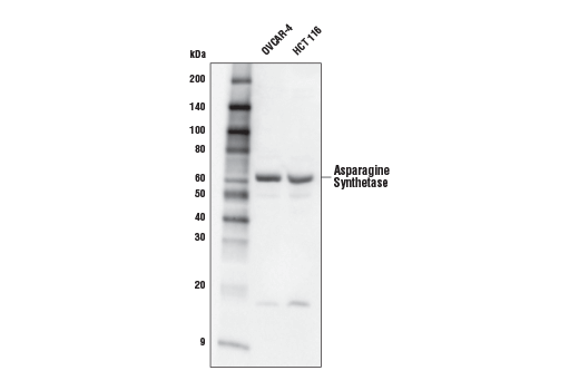 Western Blotting Image 1: Asparagine Synthetase Antibody
