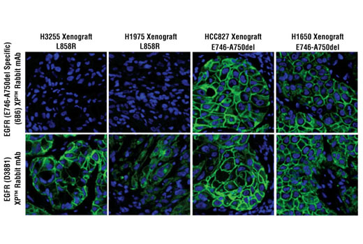 Immunofluorescence Image 1: EGF Receptor (E746-A750del Specific) (D6B6) XP® Rabbit mAb