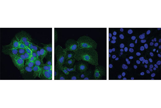 Immunofluorescence Image 2: EGF Receptor (E746-A750del Specific) (D6B6) XP® Rabbit mAb