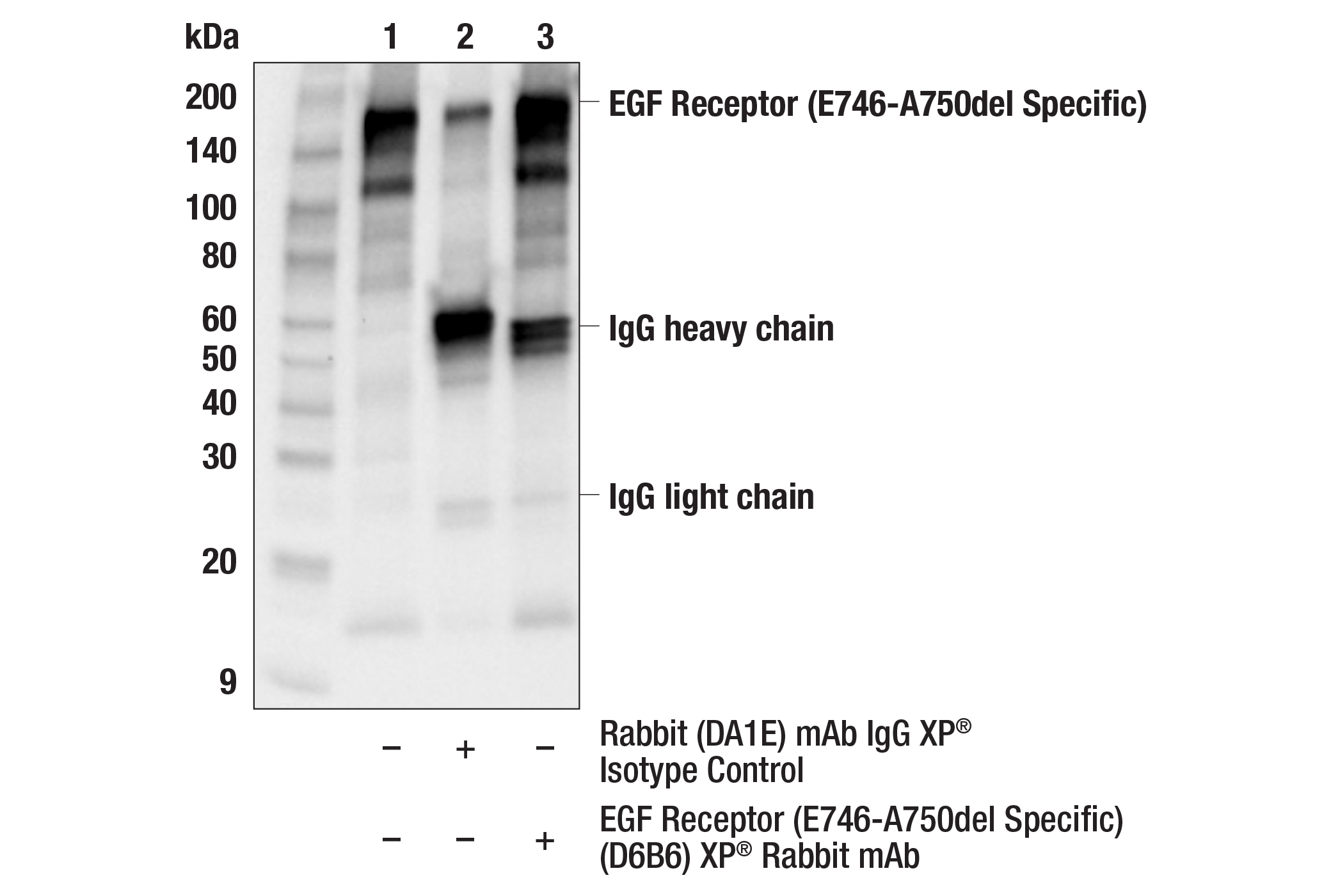 Immunoprecipitation Image 1: EGF Receptor (E746-A750del Specific) (D6B6) XP® Rabbit mAb