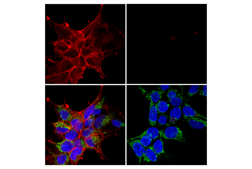 Immunofluorescence Image 1: DYKDDDDK Tag (D6W5B) Rabbit mAb (Binds to same epitope as Sigma's Anti-FLAG® M2 Antibody) (Alexa Fluor® 594 Conjugate)