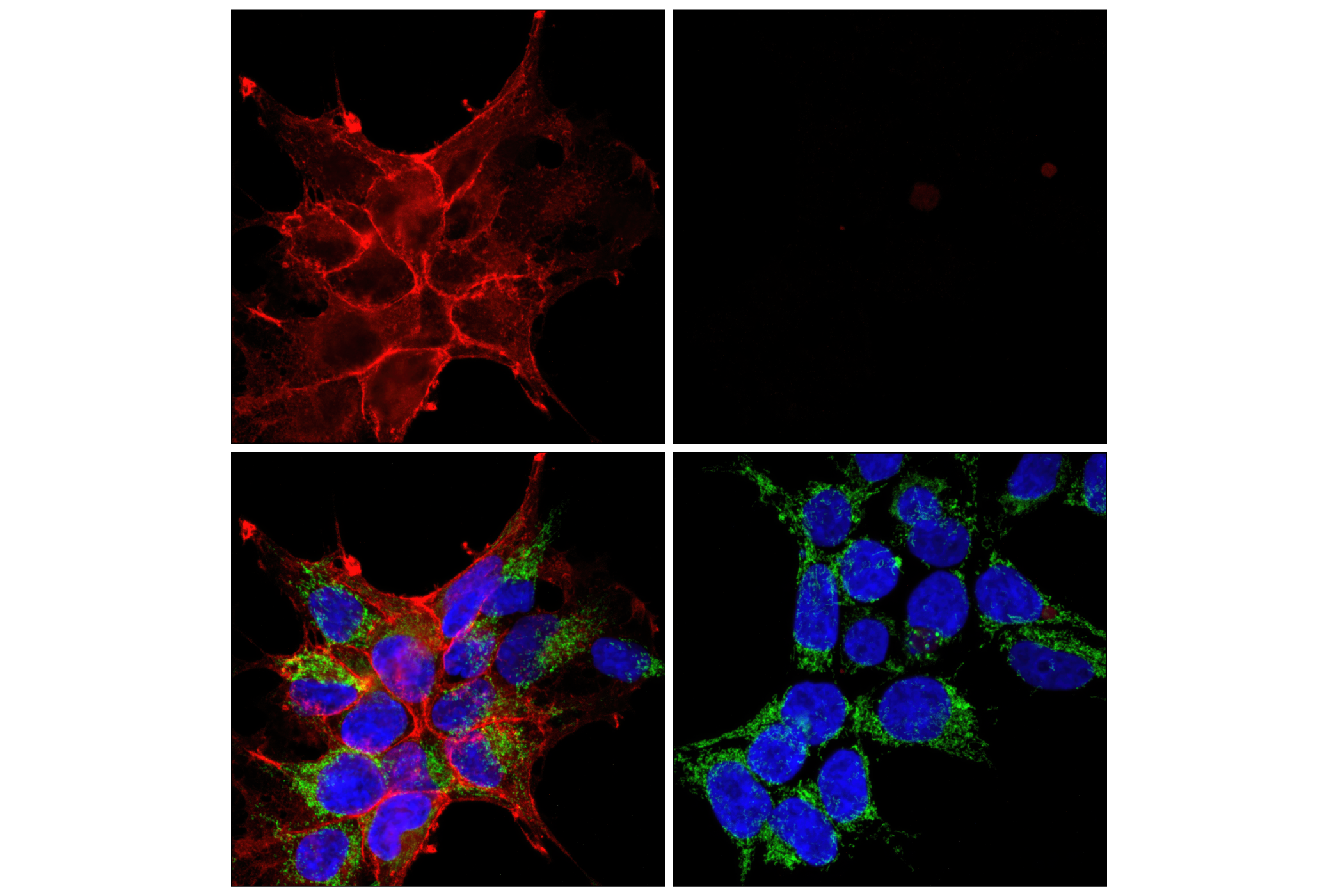 Immunofluorescence Image 1: DYKDDDDK Tag (D6W5B) Rabbit mAb (Binds to same epitope as Sigma-Aldrich Anti-FLAG M2 antibody) (Alexa Fluor® 594 Conjugate)